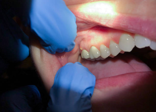 Best Emergency Denture Repair in Green Valley, CA
