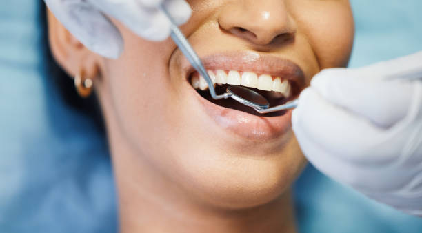 Best Emergency Dental Care for Broken or Chipped Teeth in Green Valley, CA